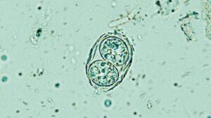 Un parassita cerebrale che infetta milioni è molto meno sonnolento di quanto pensassimo