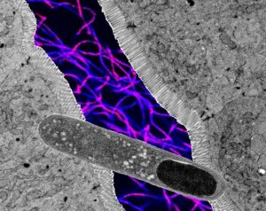 I ricercatori hanno scoperto un microbo intestinale che può fermare da solo l'aumento di peso nei topi
