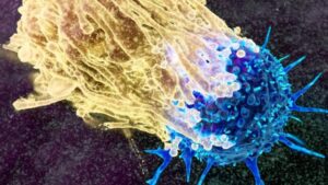 Macrofago color crema che attacca una cellula cancerosa blu, illustrazione