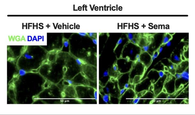 Muscolo cardiaco di topo a confronto con e senza semaglutide