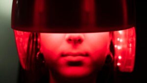 La nuova terapia della luce può sopprimere un marker chiave della perdita dei capelli del 92%