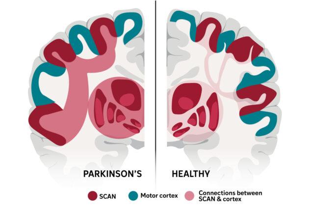 SCAN