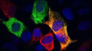 immagine al microscopio delle proteine del reticolo endoplasmatico