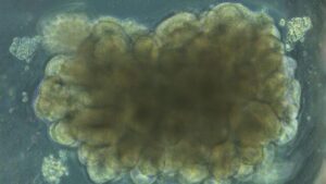 Gli scienziati hanno coltivato mini cervelli, poi li hanno addestrati a risolvere un problema ingegneristico