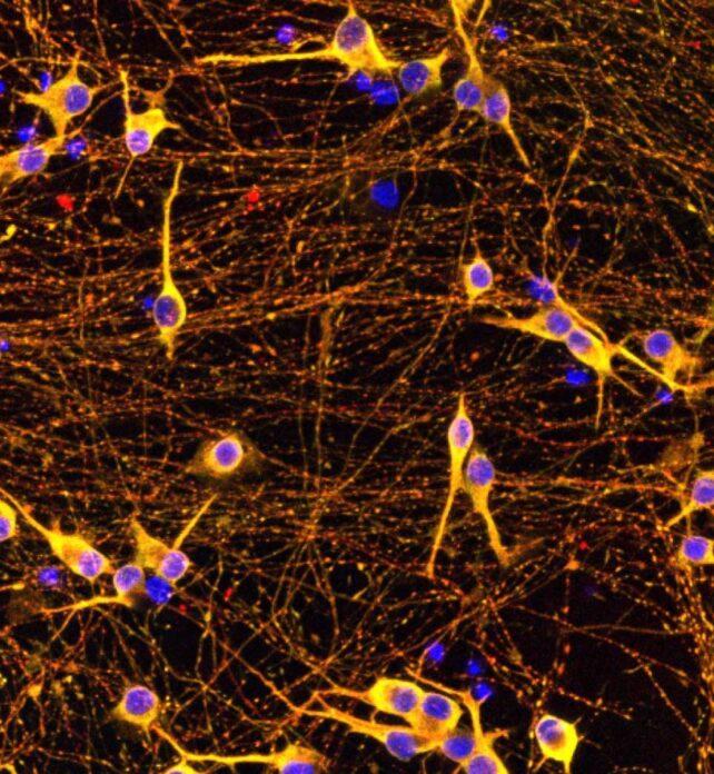 Cellule gialle e viola in una matrice di fibre marrone rossiccio