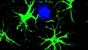 immagine di astrociti che mirano a una proteina legata alla malattia di Alzheimer