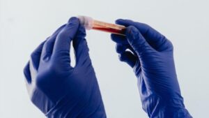 Mani guantate che tengono un campione di sangue