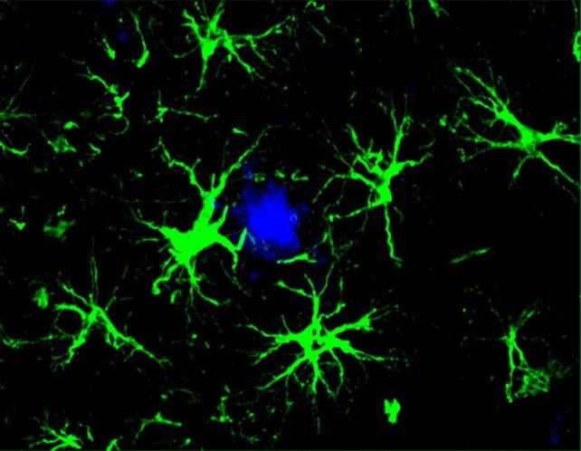 immagine di astrociti che mirano a una proteina legata alla malattia di Alzheimer