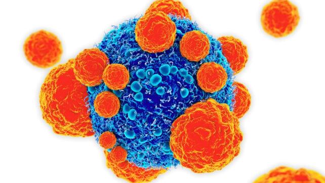 Illustrazione di cellule T arancioni che attaccano una cellula cancerosa blu