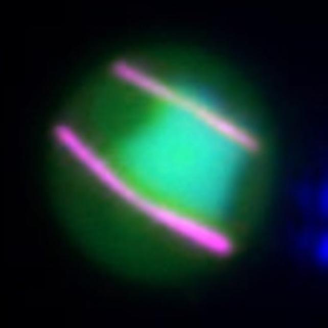 cellula del parassita della malaria con chinasi aurora visibili
