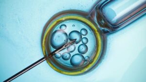 Un microscopio su cellule, che rappresenta la FIV