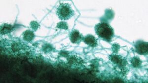 Oggetti verdi e pelosi a forma di palla, visti al microscopio