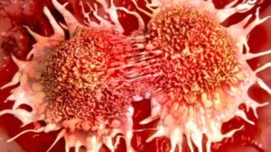 Illustrazione scientifica che mostra le cellule cancerose che si dividono