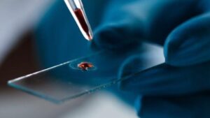 Pipettare una goccia di sangue su un vetrino