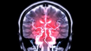 risonanza magnetica del cervello bagliore rosso