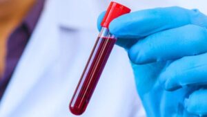 tubo di sangue