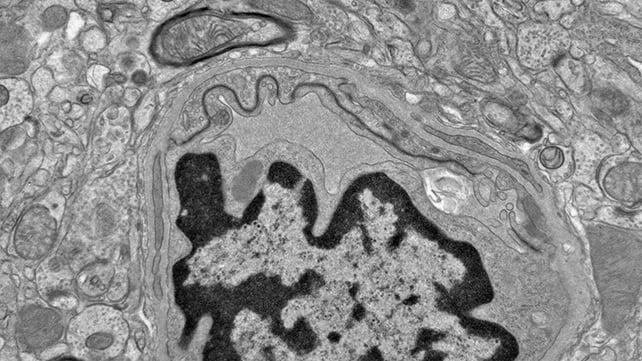 Scansione del tessuto cerebrale
