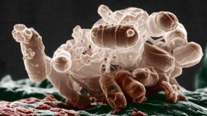 Un gruppo marrone di batteri E. coli, visto al microscopio