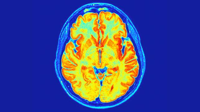Sezione MRI assiale di un cervello umano