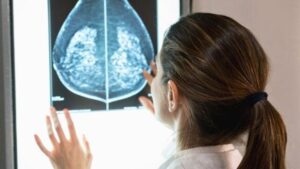 Clinico che esamina una mammografia come parte dello screening per il cancro al seno
