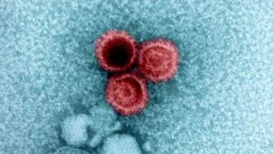 virus di Epstein-Barr