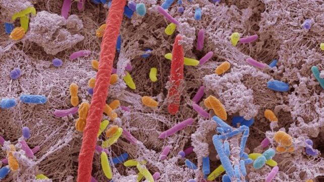 Immagine al microscopio di batteri orali.