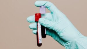 mano che tiene tubi di sangue