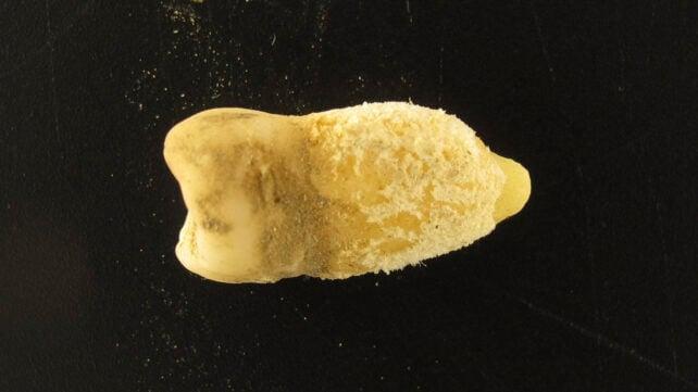 Un dente di mummia boliviana