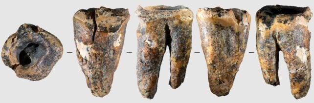 I Neanderthal stavano già perforando cavità dentali 60.000 anni fa
