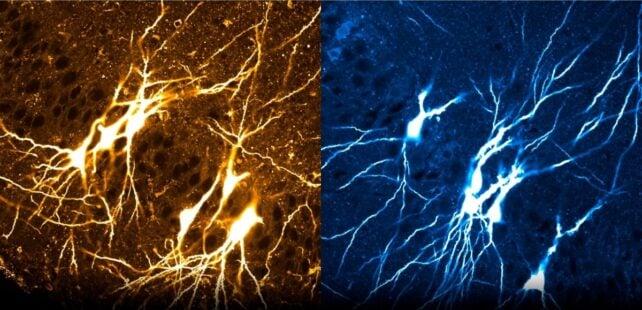 I nostri cervelli potrebbero nascere 'pieni', non come una tabula rasa