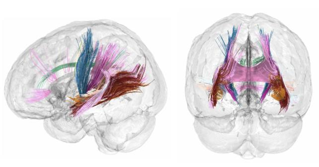 Risonanza magnetica della connettività cerebrale