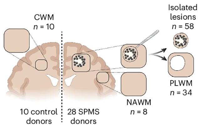 Campioni di tessuto cerebrale