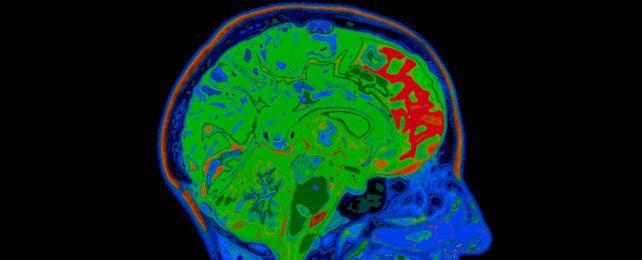 Risonanza magnetica del cervello umano