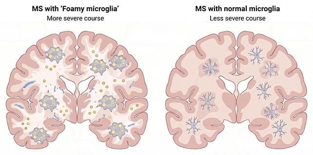 Analisi della microglia