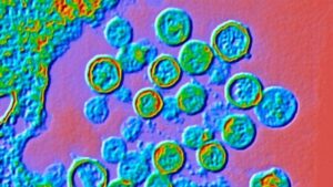 Le indagini iniziano dopo il sospetto focolaio di un raro hantavirus che ha ucciso 3 persone