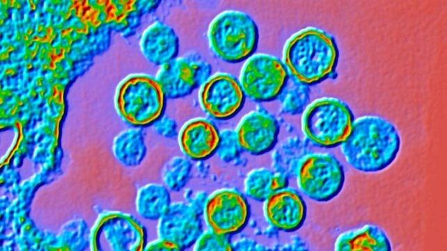 ColourEnhancedTransmissionElectronMicrographOfHantavirus-642x361-1.jpg