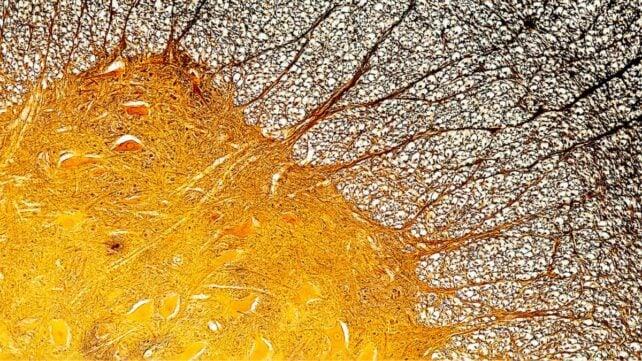CrossSectonOfSpinalCordShowingNervesAndMicroglia-642x361-1.jpg