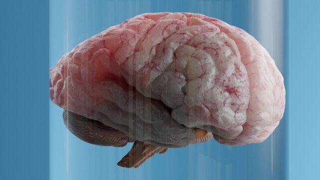 Fatty-Looking-Brain-In-Water-642x361-1.jpg