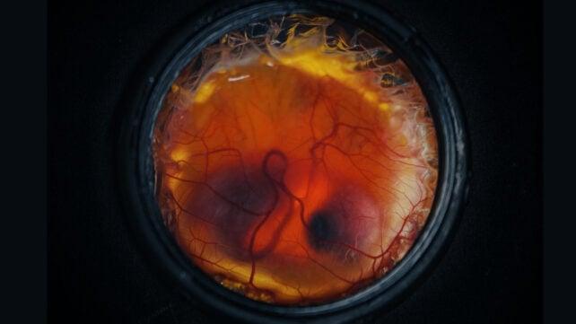 Un embrione di pulcino in sviluppo è visibile all'interno di un contenitore di guscio d'uovo artificiale, con vasi sanguigni che si estendono sulla superficie.