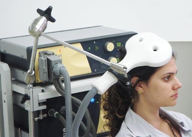 stimolazione magnetica del cervello