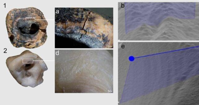 I Neanderthal stavano già perforando cavità dentali 60.000 anni fa