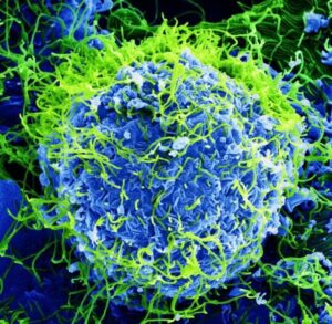 Dichiarata Emergenza Globale per l'Outbreak Mortale di Ebola mentre i Casi si Diffondono in Africa