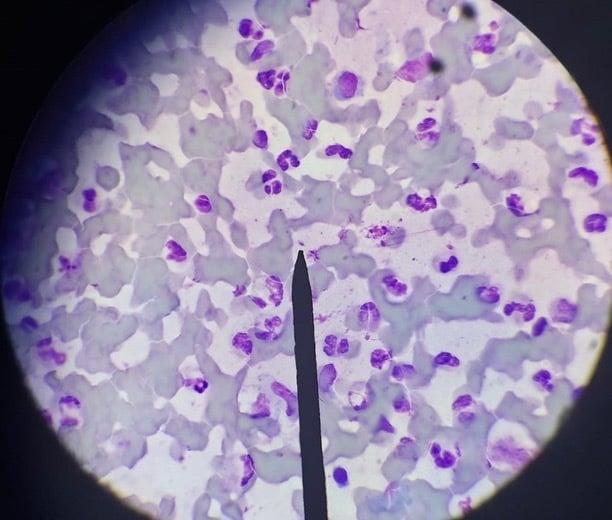 microscopia che mostra numerosi parassiti Leishmania