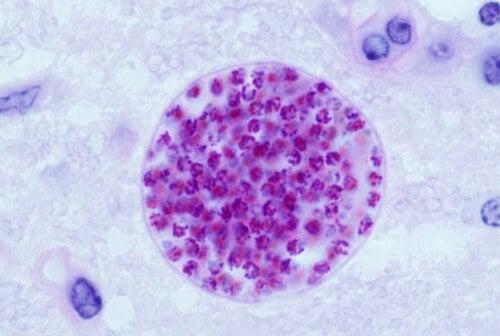 Parassita che infetta milioni T. gondii
