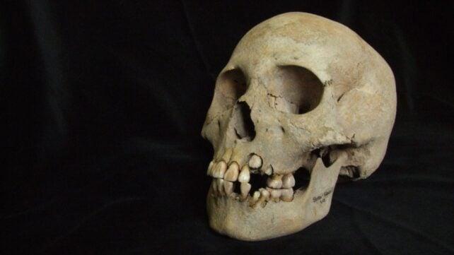 Il DNA rivela che un antico assassino era già mortale 5.500 anni fa