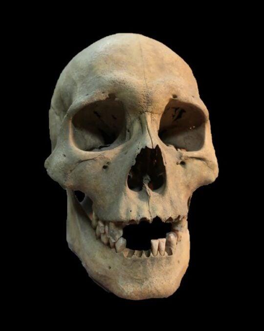 Il batterio della peste stava uccidendo i cacciatori-raccoglitori 5.500 anni fa