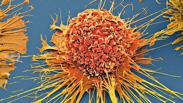 Nuovo martello molecolare: la migliore innovazione contro il cancro