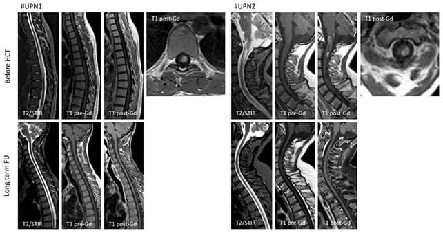 Scansioni MRI