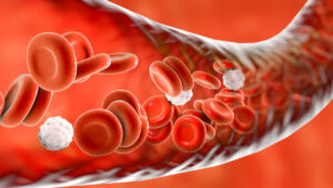 Un nuovo trattamento per il colesterolo potrebbe rimuovere le microplastiche presenti nel sangue