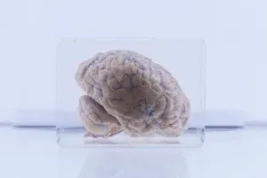 Perché alcuni cervelli umani sono sopravvissuti per oltre 10.000 anni mentre il corpo si decomponeva?
